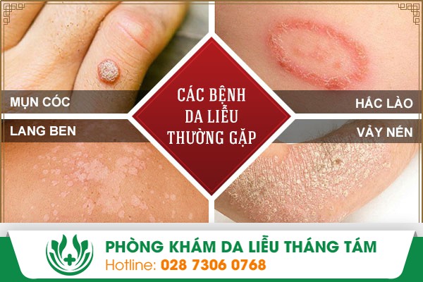 phòng khám da liễu quận 9
