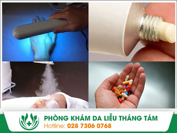 sần sùi và ngứa