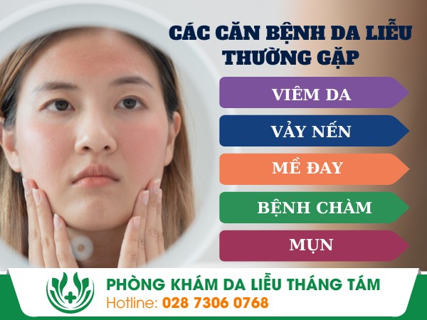 địa chỉ khám bệnh da liễu
