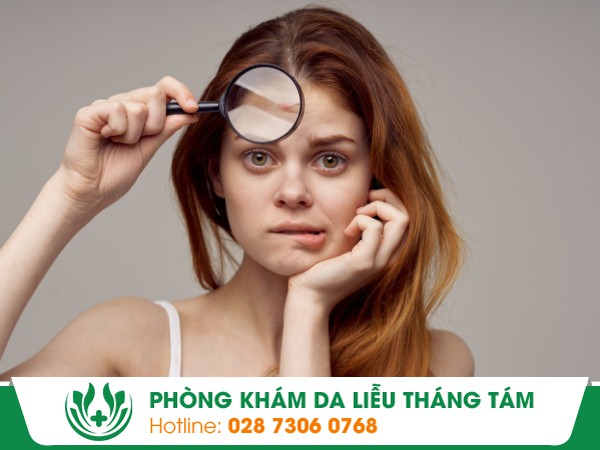 nấm da