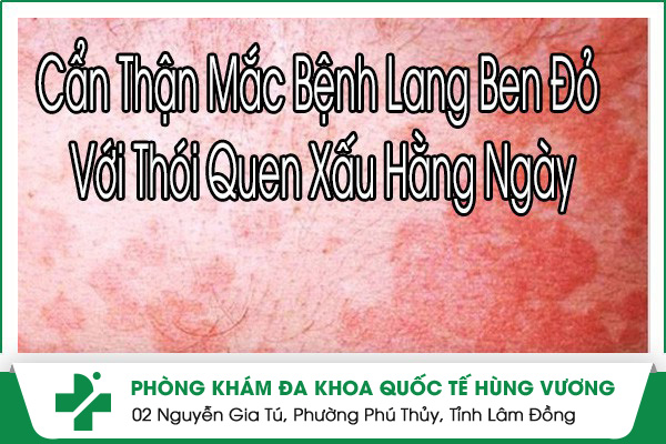 Bệnh Lang Ben Đỏ Có Nguy Hiểm Không?