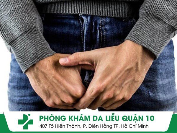 chàm bìu