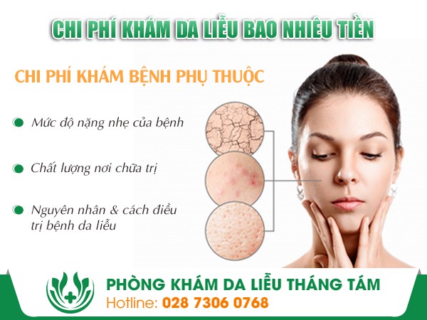 chi phí khám chữa da liễu