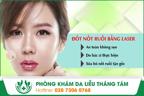Xóa nốt ruồi an toàn bằng phương pháp Lazer tại Phòng Khám Da Liễu Tháng Tám
