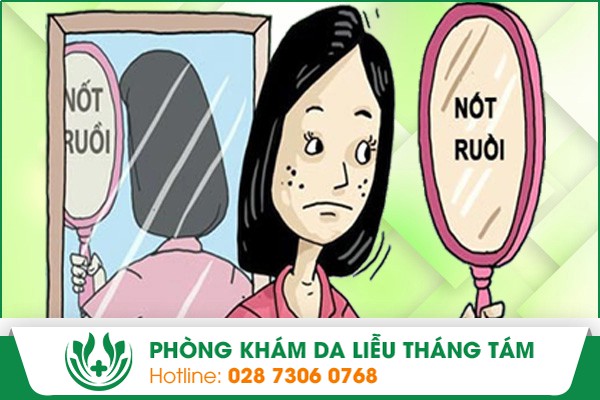 Tự ý xóa nốt ruồi tại nhà để lại nhiều biến chứng