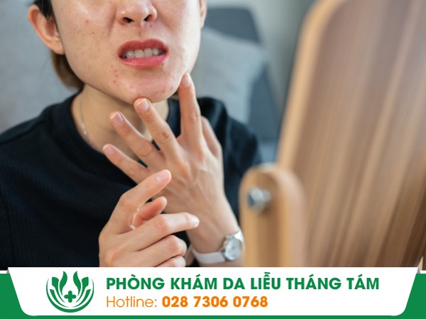 sần sùi và ngứa