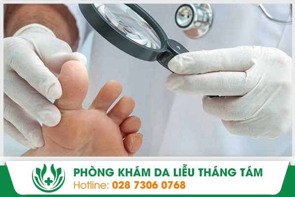 nấm móng