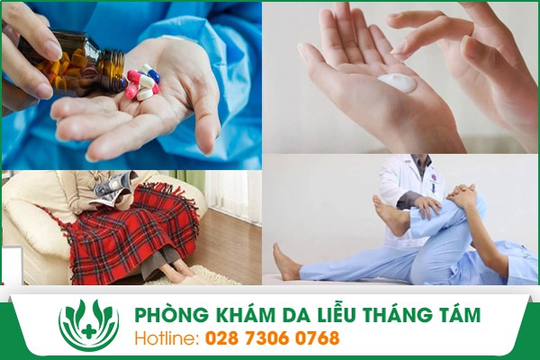 Những phương pháp hỗ trợ chữa trị bệnh xơ cứng bì