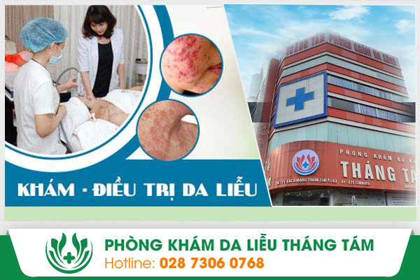 chi phí khám chữa da liễu