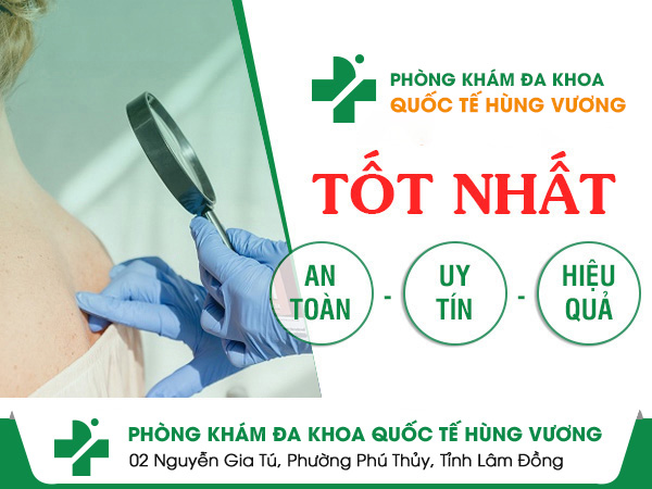 Phòng khám da liễu ngoài giờ uy tín bậc nhất TPHCM