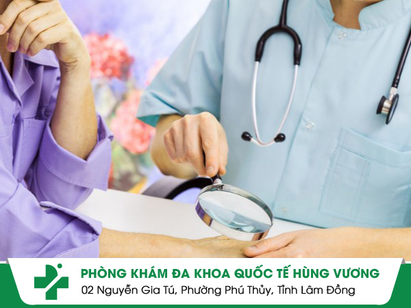 Nên lựa chọn phòng khám da liễu quận 9 nào để đảm bảo hiệu quả điều trị?