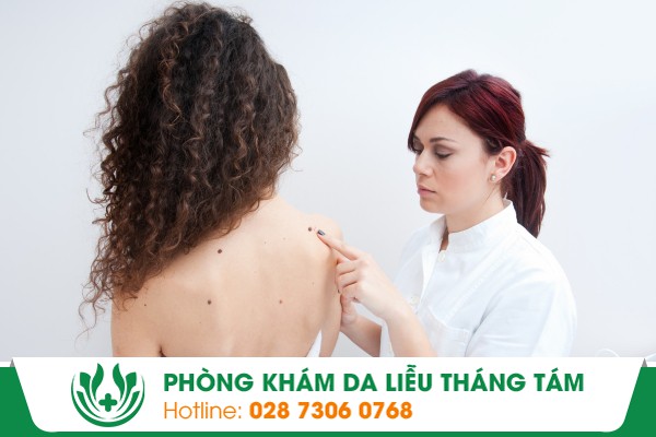 phòng khám da liễu quận 7