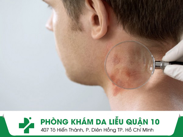 phòng khám da liễu tỉnh Bà Rịa - Vũng Tàu