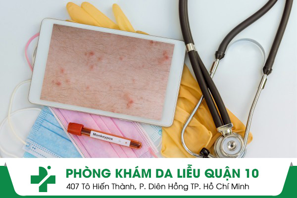 phòng khám da liễu tỉnh Tây Ninh