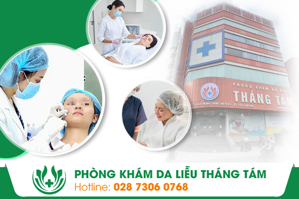 bệnh viện da liễu bắn nốt ruồi thẩm mỹ