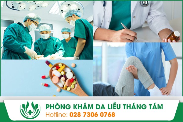 Các phương pháp trị bệnh xơ cứng bì