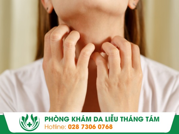 sẩn ngứa