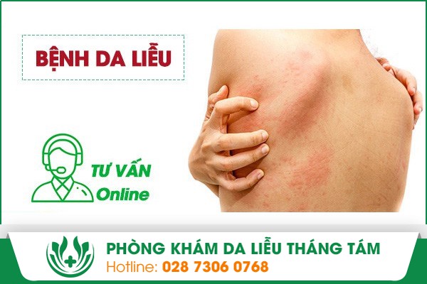 Những lợi ích khi người bệnh lựa chọn dịch vụ tư vấn trực tuyến